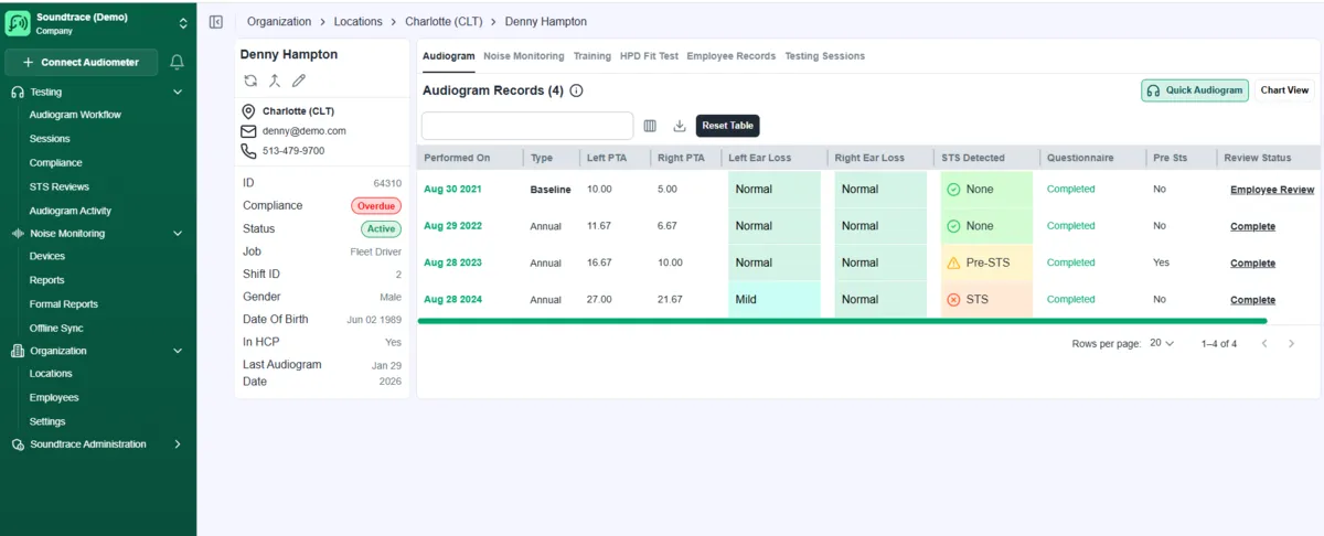 Denny Hampton employee profile showing 4 years of audiogram records with automatic STS detection - baseline through annual tests with hearing trend badges